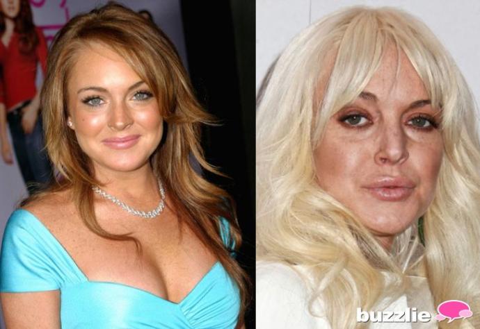 Actresses Before & After Drugs/Alcohol/Health Issues
