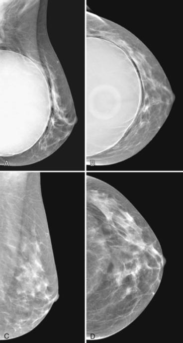 My experience getting a mammogram and what you can do to get the most out of yours!