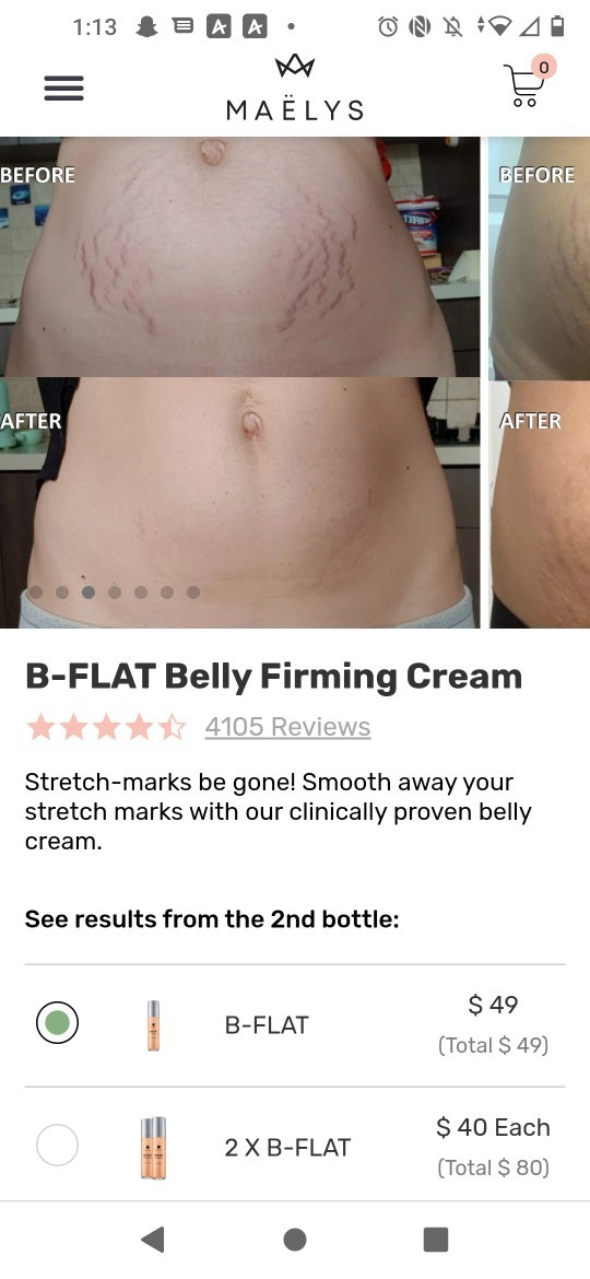 What really helps stretch marks to fade