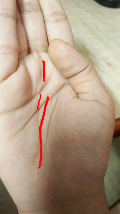 I have two fate lines