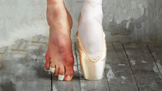 Professional ballet ruined my mental health.