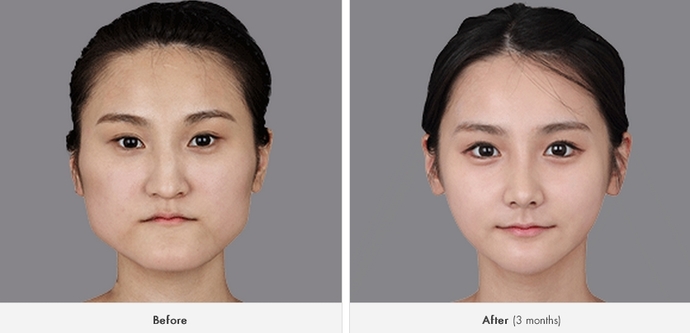 Do anime characters look European or Asian?