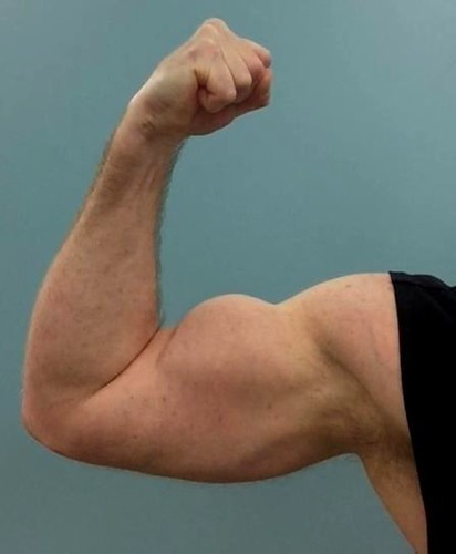 Natural lifters shouldnt train in the same way as steroid users do.
