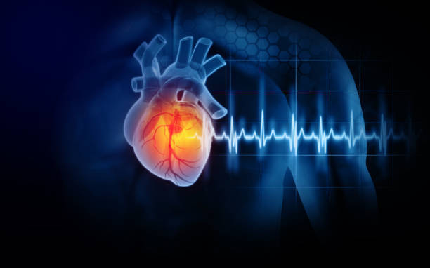 Have you ever had, or suspected that you have had a heart attack?