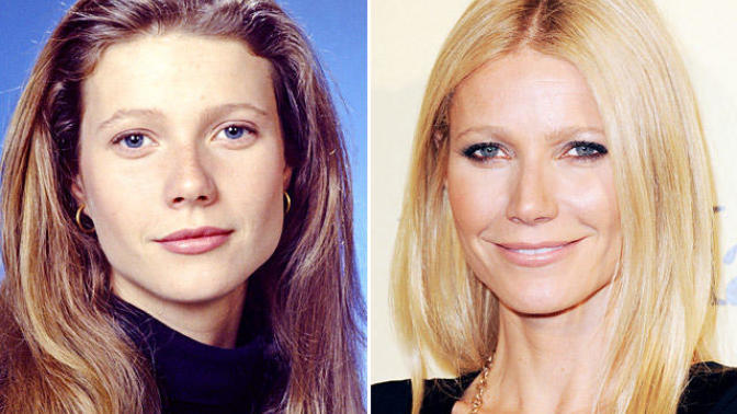 Celebrity Plastic Surgery: The Good, The Bad & The Ugly