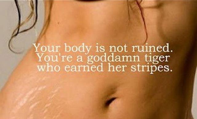 So You Wanna Get Rid of Your Stretch Marks?