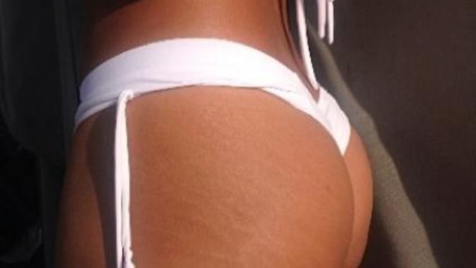 So You Wanna Get Rid of Your Stretch Marks?