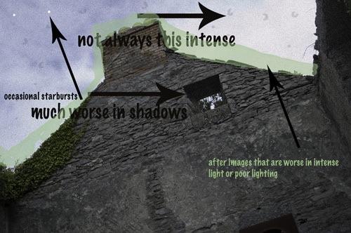 Visual Snow: Statics in My Vision 24/7