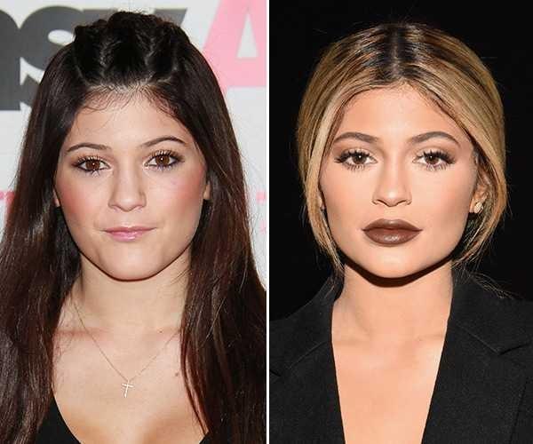 How unattractive are thin lips?