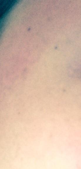 why is my face so red?