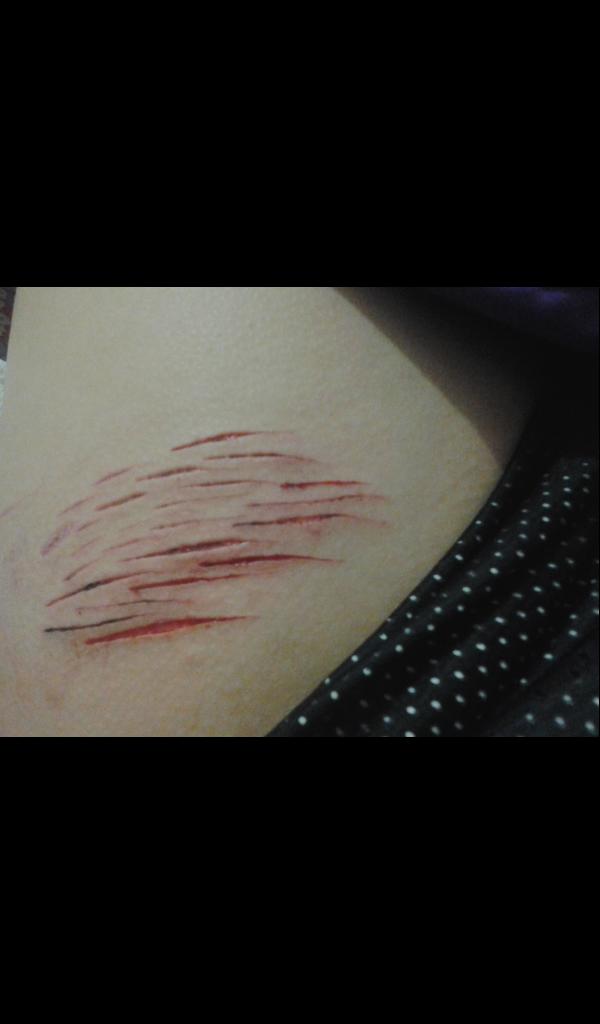 Will these cuts scar?