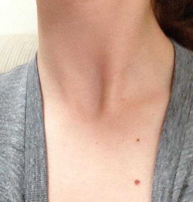 How do you feel about freckles like these on my neck/chest?