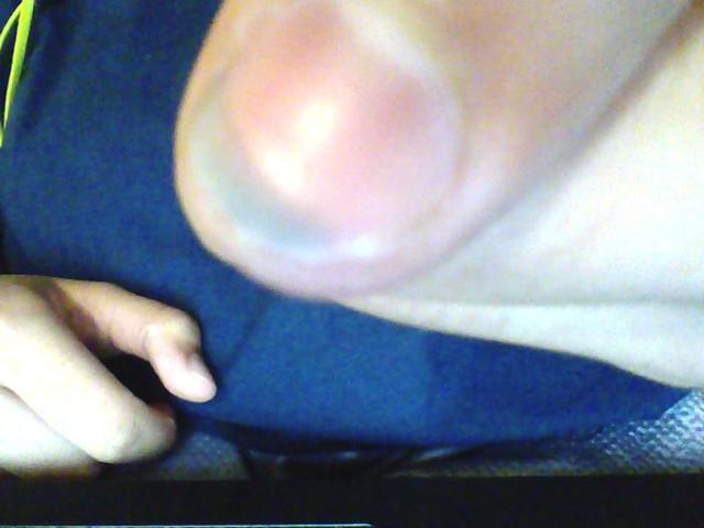 Help! I Hurt my nail?
