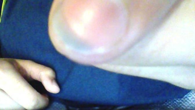 Help! I Hurt my nail?