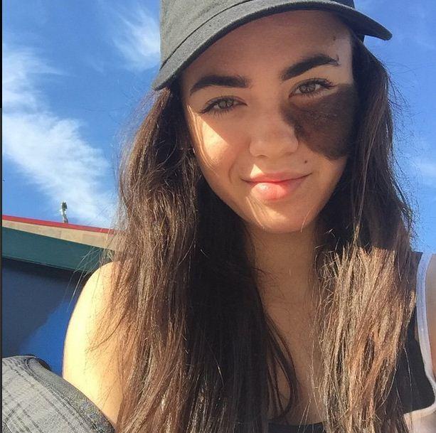 Do you think this girl looks beautiful with her birth mark?