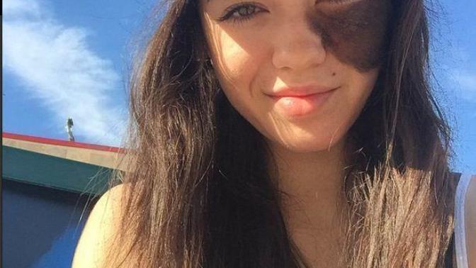 Do you think this girl looks beautiful with her birth mark?