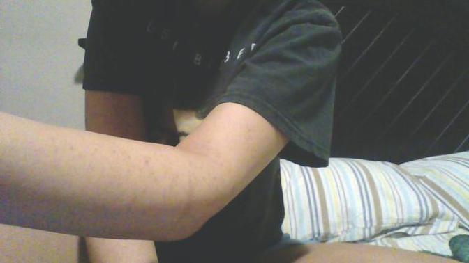 How to remove acne scars on arms?