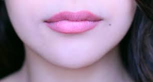 Crooked lips? Is this a big deal?