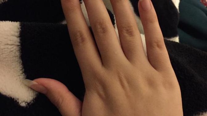 Is my nails too long or gross?