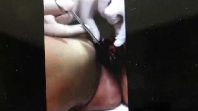 What's one of the most sickeningly disgusting things you've ever seen or watched on the internet?