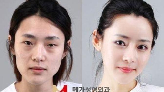 Plastic surgeries in Korea > why do they make themselves look completely unrecognizable?