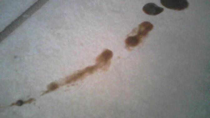 Pooped my sheets and can't get the stain out?