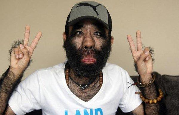 Would you rather be with a man who was super ultra hairy or had absolutely no hair at all anywhere on his body or head?