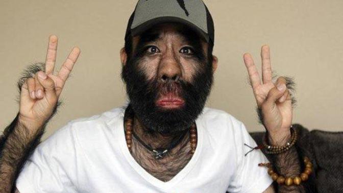 Would you rather be with a man who was super ultra hairy or had absolutely no hair at all anywhere on his body or head?