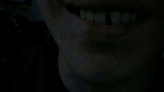 Should l get the gap in my teeth fixed?