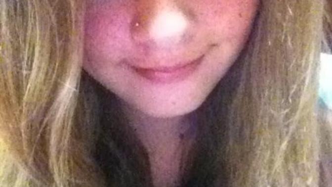 Girls, Have hair issues please help?