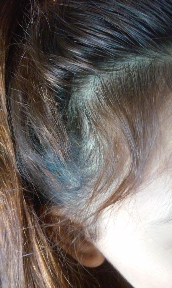 Girls, Am I thinning hair or losing hair (pictures included) help?