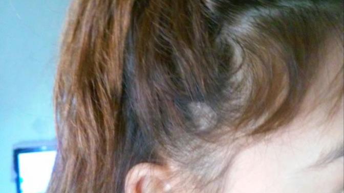 Girls, Am I thinning hair or losing hair (pictures included) help?