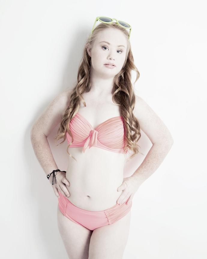 A model with down syndrome? What do you think about it?