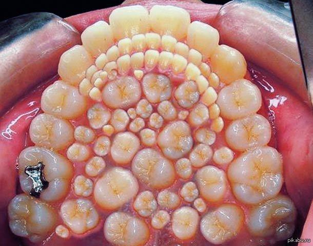 Do I have trypophia fetish? Is it weird That I do?