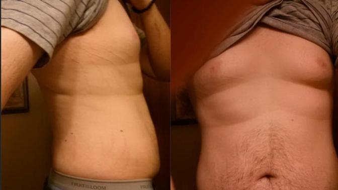 Rate my body! (After 100lbs Weight Loss)?