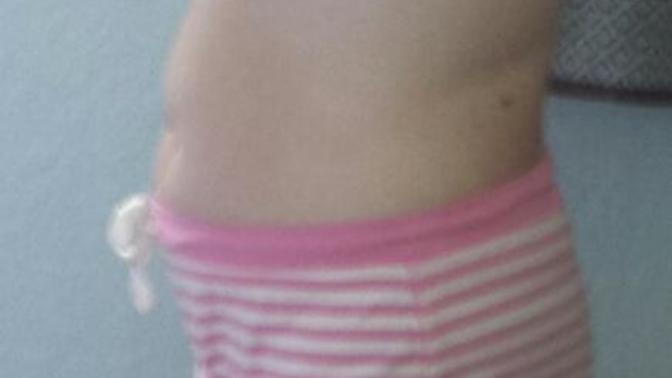 Guys, Am I fat?