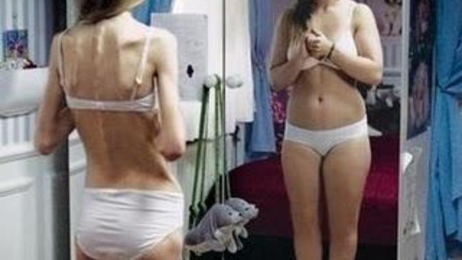 Girls: How many of you can admit to starving yourself at some point in your life? Which reason best relates to why you decided to do so?