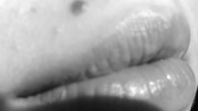 Are moles above upper lip considered attractive?
