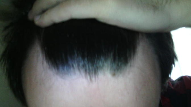 Long hair on a receding hairline?