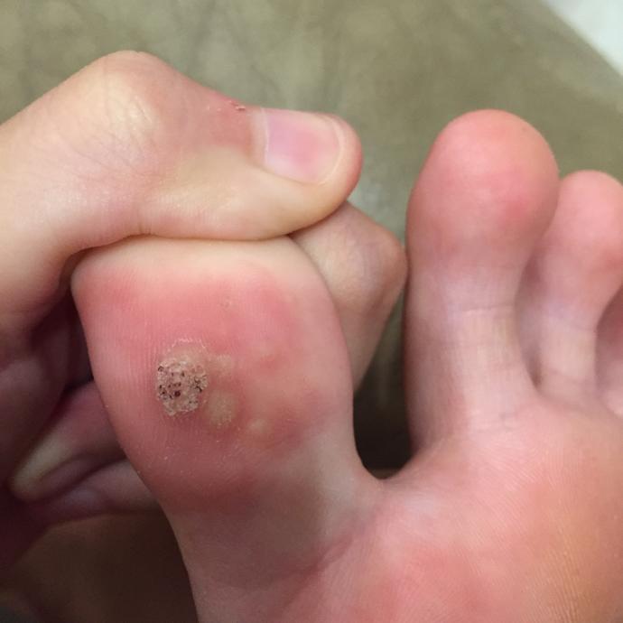 😱what happen to my toe !?