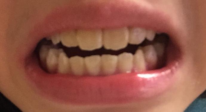 how to make my teeth whiter ?
