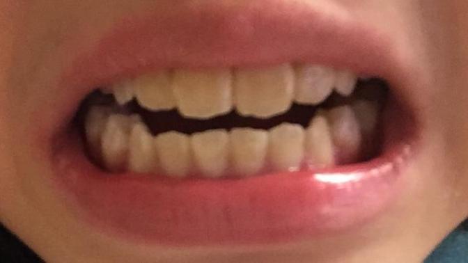 How to make my teeth whiter?