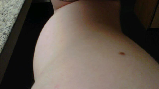 HELP! WHY ARE MY BICEPS GROWING INWARDS?