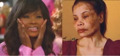 What do you guys think about girls who skin bleach, and the affects that skin bleaching can have?