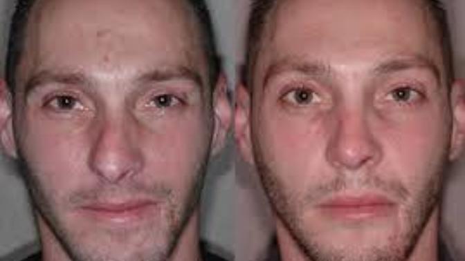 Girls, Do you think having a bent nose can make a big impact on whenever a guy is attractive or not?