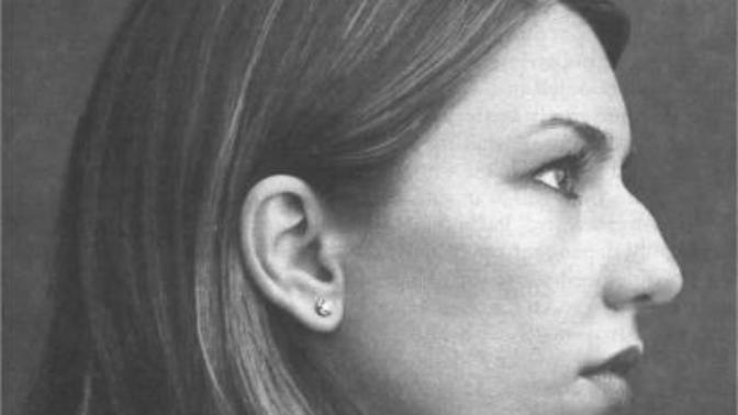 Are girls with big noses attractive?