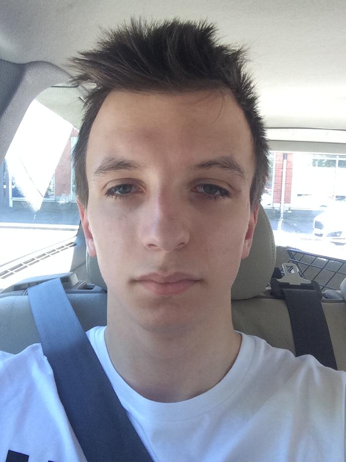 Is my forehead to big? If so do you think forehead reduction surgery would make me look more attractive?