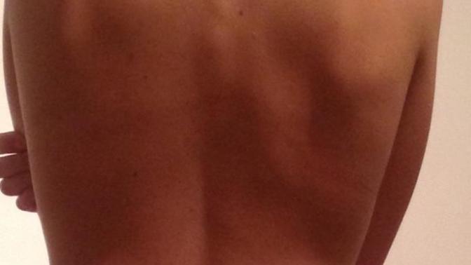 Is my back masculine/ugly?