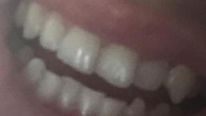 Are my teeth ugly?
