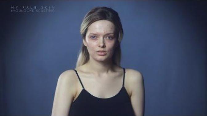 Do you think acne makes people ugly?